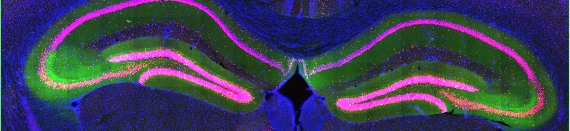 Hippocampus
