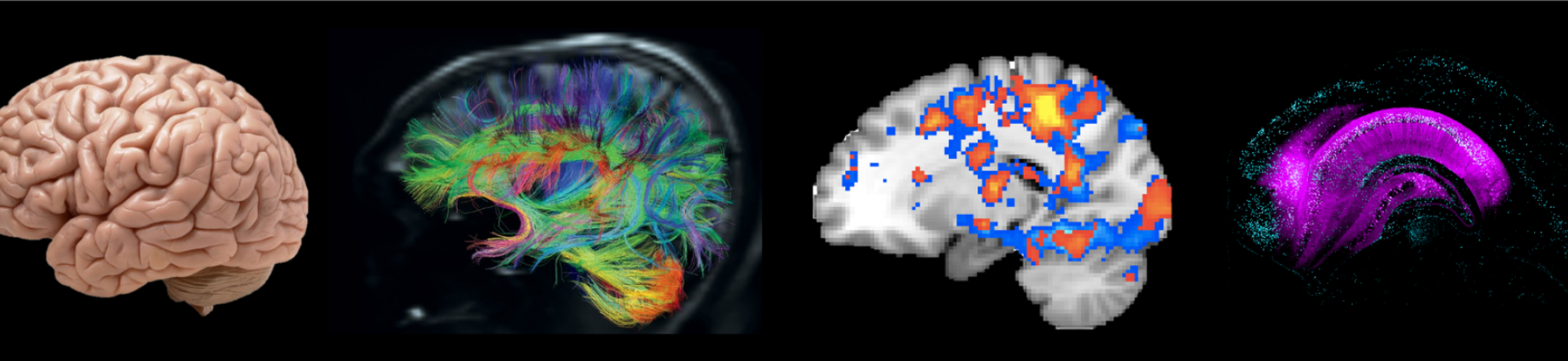 Brain Banner